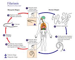 Filariasis Wikipedia