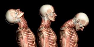 They move the head in every direction, pulling the skull and jaw towards the shoulders, spine, and scapula. Whiplash Causes Symptoms And Treatments