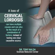 reversal of cervical lordosis what is