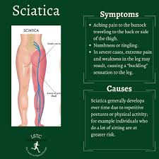 sciatica pain archives loudoun sports