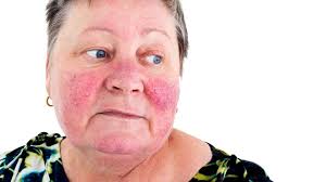 common skin rashes
