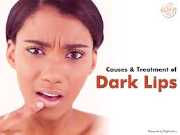 treatments prevention of dark lips