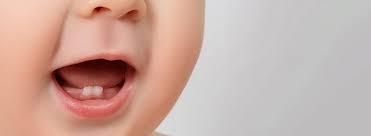 white or brown spots on baby teeth crest