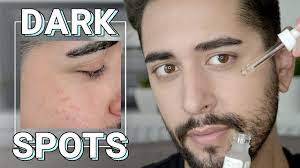 how to remove dark spots on face pt 2