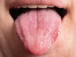 tongue cancer images browse 1 001