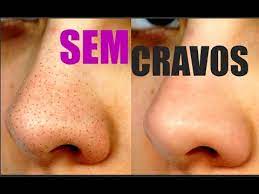 como remover cravos do nariz receita