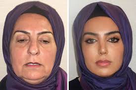 turkish plastic surgery clinic