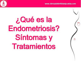 El síntoma principal de la endometriosis es el dolor pélvico, a menudo asociado con los períodos menstruales. Que Es La Endometriosis Sintomas Y Tratamientos
