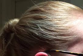 Have dyed hair using garnier nutrisse 111+ very light ash blonde. Hair Dye Failure It S Turned Grey Ffs Mumsnet