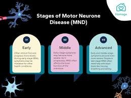 motor neurone disease mnd 101 causes