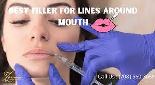 best filler for lines around mouth