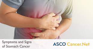stomach cancer symptoms and signs
