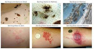 bed bug symptoms pictures when they