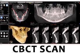 cone beam ct scan cbct and how does