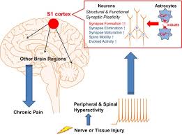 The awareness of the 3. Functional And Structural Plasticity In The Primary Somatosensory Cortex Associated With Chronic Pain Kim 2017 Journal Of Neurochemistry Wiley Online Library
