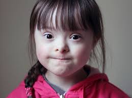 Experts Outline Down Syndromes Developmental Milestones