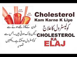 Cholesterol Kam Karne Ke Liye Urdu Main Sub Kuch