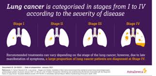 at the forefront of lung cancer treatment