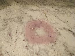 Marble Stain Or Etch How To Tell The