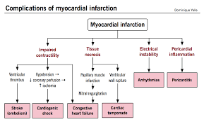 Ischemic Heart Disease Mcmaster Pathophysiology Review