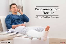 recovering from fracture 6 foods you
