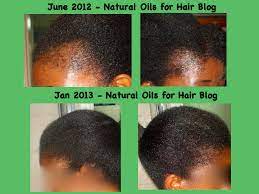 Get great deals on ebay! Regrow Bald Spots With Jamaican Black Castor Oil Castor Oil For Hair Jamaican Black Castor Oil Hair Growth Castor Oil For Hair Growth