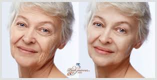 face wrinkle retouch remove wrinkles