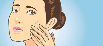 what causes acne scars and how to get