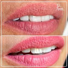 permanent lips pigmenta