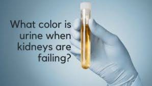 what color is urine when kidneys are