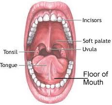 cancers of the floor of the mouth