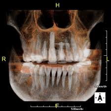 3d cone beam imaging parkersburg wv