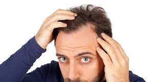 itching scalp and hair loss what is
