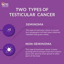 treatment of testicular cancer