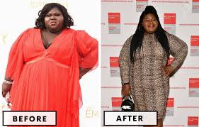 top 21 celebrity bariatric surgery