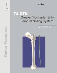t2 greater trochanter entry fem