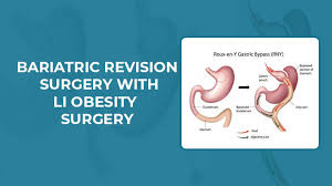 bariatric revision surgery gastric