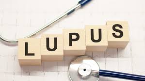 systemic lupus erythematosus what it