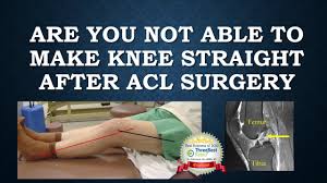after acl surgery