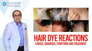 hair dye allergy symptoms causes