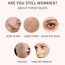 coverage concealer acnes