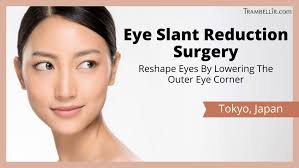 eye slant reduction surgery reshape
