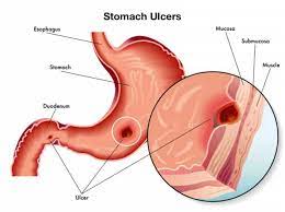 stomach ulcers in dogs causes