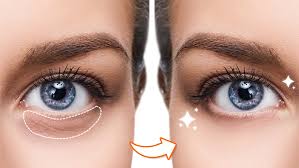 how to remove dark circles from photos