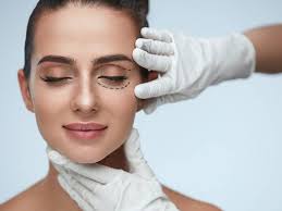 blepharoplasty beverly hills what you