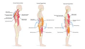 The quadratus lumborum muscles (orange, in the image above) are found in the lower back (also called the lumbar area). Muscles That Cause The Most Back Pain And How To Get Relief Tender Touch Therapies
