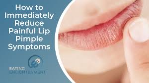 painful lip pimple symptoms
