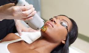laser treatments in bowie maryland