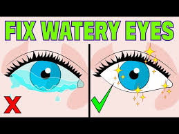how to stop watery eyes at home in 3