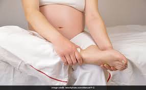 swollen hands and feet during pregnancy